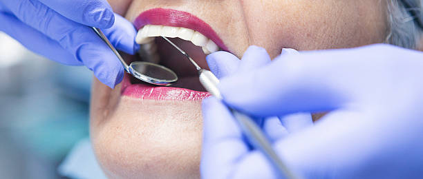 Best Emergency Treatment for Toothache in Mogadore, OH